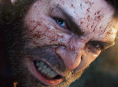 Marvel's Wolverine actor studied rabid dogs to play a more feral Logan