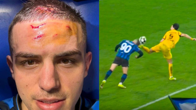 Atalanta's Nikola Krstović shows his forehead after dramatic last-minute penalty against BVB