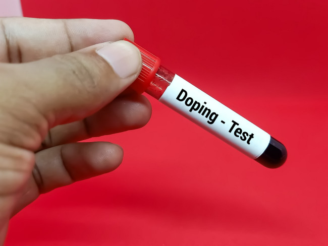 Tour de France anti-doping tests cause complaints between riders and some accusations of rigging