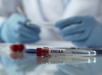 WHO claims Congo's Ebola outbreak has the largest number of first-month confirmed cases to date