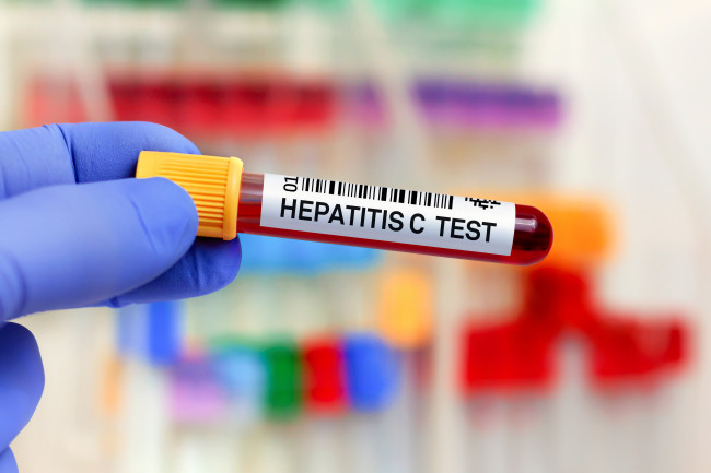 England on track to become one of first countries to eliminate hepatitis C