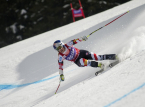 American skier Lindsey Vonn undergoes third surgery in her leg