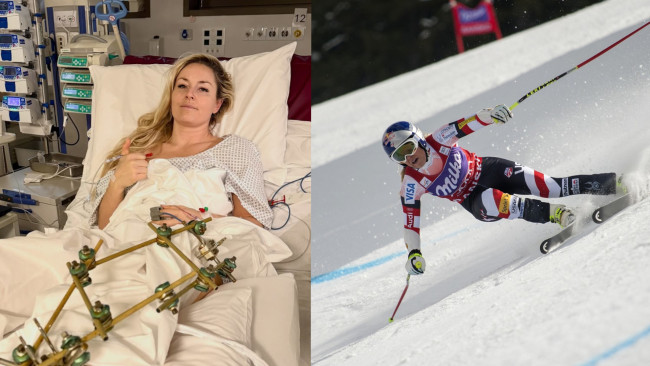 American skier Lindsey Vonn undergoes third surgery in her leg